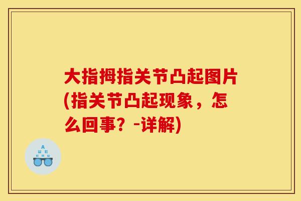 大指拇指关节凸起图片(指关节凸起现象,怎么回事?-详解) 大指拇指关节凸起图片(指关节凸起现象,怎么回事?-详解)