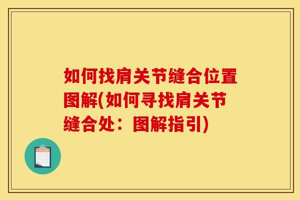 如何找肩关节缝合位置图解(如何寻找肩关节缝合处：图解指引)