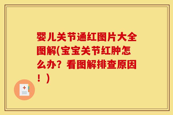 婴儿关节通红图片大全图解(宝宝关节红肿怎么办?看图解排查原因!) 婴儿关节通红图片大全图解(宝宝关节红肿怎么办?看图解排查原因!)
