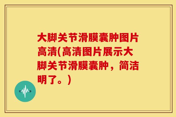 大脚关节滑膜囊肿图片高清(高清图片展示大脚关节滑膜囊肿，简洁明了。)