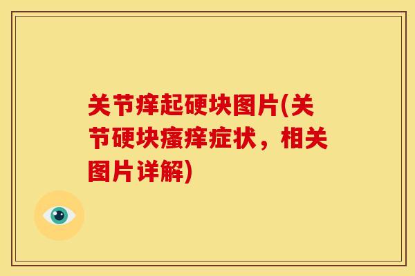 关节痒起硬块图片(关节硬块症状,相关图片详解) 关节痒起硬块图片(关节硬块症状,相关图片详解)