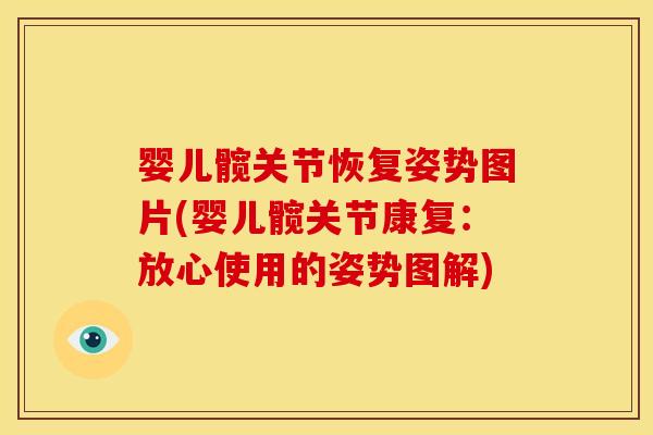 婴儿髋关节恢复姿势图片(婴儿髋关节康复:放心使用的姿势图解) 婴儿髋关节恢复姿势图片(婴儿髋关节康复:放心使用的姿势图解)