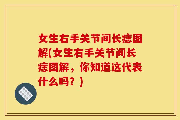 女生右手关节间长痣图解(女生右手关节间长痣图解，你知道这代表什么吗？)