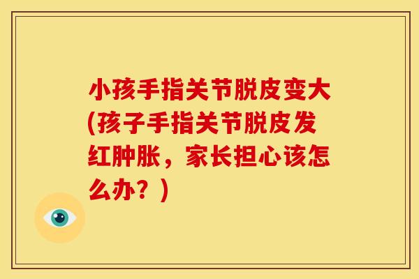 小孩手指关节脱皮变大(孩子手指关节脱皮发红,家长担心该怎么办?) 小孩手指关节脱皮变大(孩子手指关节脱皮发红,家长担心该怎么办?)