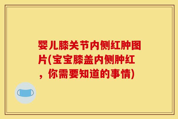 婴儿膝关节内侧红肿图片(宝宝膝盖内侧肿红,你需要知道的事情) 婴儿膝关节内侧红肿图片(宝宝膝盖内侧肿红,你需要知道的事情)
