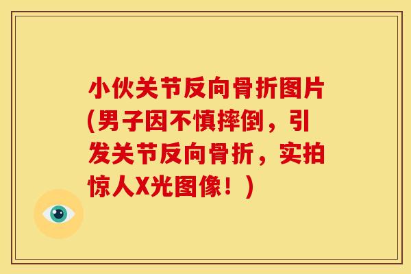 小伙关节反向图片(男子因不慎摔倒，引发关节反向，实拍惊人X光图像！)