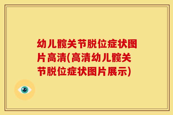 幼儿髋关节脱位症状图片高清(高清幼儿髋关节脱位症状图片展示) 幼儿髋关节脱位症状图片高清(高清幼儿髋关节脱位症状图片展示)