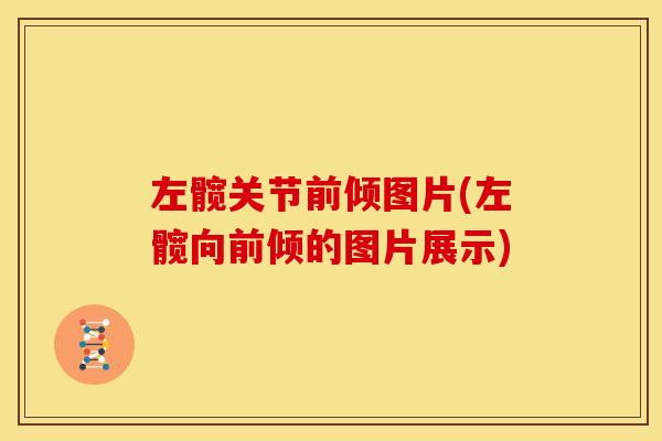 左髋关节前倾图片(左髋向前倾的图片展示) 左髋关节前倾图片(左髋向前倾的图片展示)