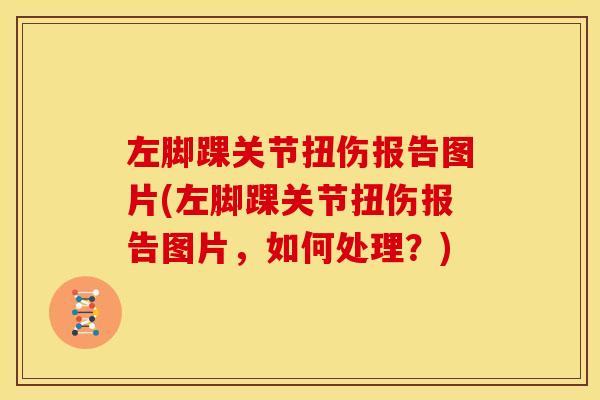 左脚踝关节扭伤报告图片(左脚踝关节扭伤报告图片,如何处理?) 左脚踝关节扭伤报告图片(左脚踝关节扭伤报告图片,如何处理?)
