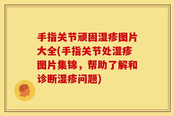 手指关节顽固图片大全(手指关节处图片集锦,帮助了解和诊断问题) 手指关节顽固图片大全(手指关节处图片集锦,帮助了解和诊断问题)