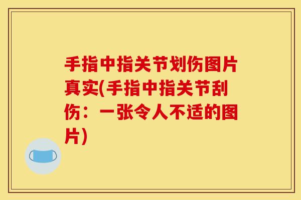 手指中指关节划伤图片真实(手指中指关节刮伤：一张令人不适的图片)