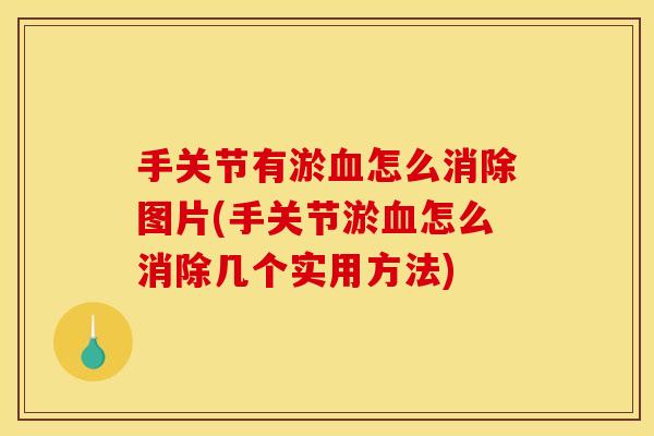 手关节有淤怎么消除图片(手关节淤怎么消除几个实用方法) 手关节有淤怎么消除图片(手关节淤怎么消除几个实用方法)