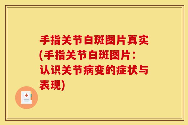 手指关节白斑图片真实(手指关节白斑图片:认识关节变的症状与表现) 手指关节白斑图片真实(手指关节白斑图片:认识关节变的症状与表现)