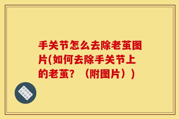 手关节怎么去除老茧图片(如何去除手关节上的老茧?(附图片)) 手关节怎么去除老茧图片(如何去除手关节上的老茧?(附图片))