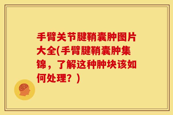手臂关节腱鞘囊肿图片大全(手臂腱鞘囊肿集锦,了解这种肿块该如何处理?) 手臂关节腱鞘囊肿图片大全(手臂腱鞘囊肿集锦,了解这种肿块该如何处理?)