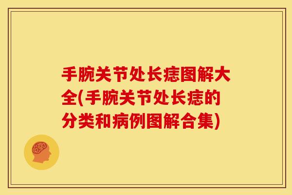 手腕关节处长痣图解大全(手腕关节处长痣的分类和例图解合集) 手腕关节处长痣图解大全(手腕关节处长痣的分类和例图解合集)