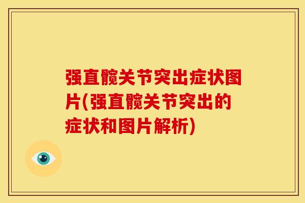 强直髋关节突出症状图片(强直髋关节突出的症状和图片解析) 强直髋关节突出症状图片(强直髋关节突出的症状和图片解析)