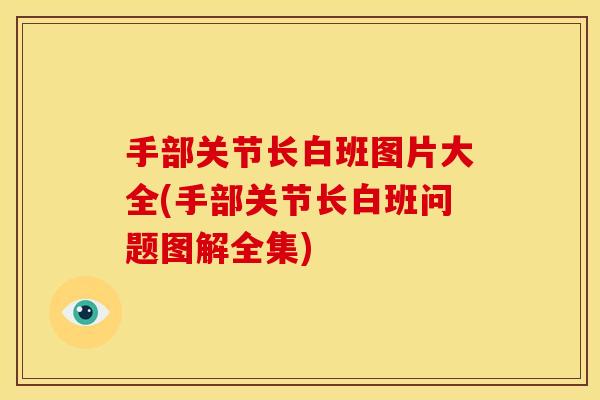 手部关节长白班图片大全(手部关节长白班问题图解全集) 手部关节长白班图片大全(手部关节长白班问题图解全集)