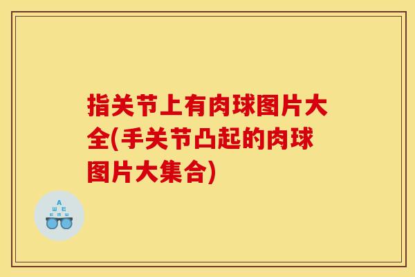 指关节上有肉球图片大全(手关节凸起的肉球图片大集合) 指关节上有肉球图片大全(手关节凸起的肉球图片大集合)