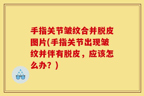 手指关节皱纹合并脱皮图片(手指关节出现皱纹并伴有脱皮，应该怎么办？)