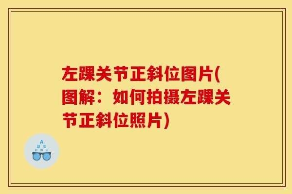 左踝关节正斜位图片(图解:如何拍摄左踝关节正斜位照片) 左踝关节正斜位图片(图解:如何拍摄左踝关节正斜位照片)