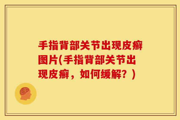 手指背部关节出现皮癣图片(手指背部关节出现皮癣，如何缓解？)