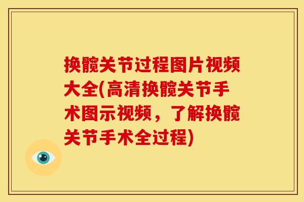 换髋关节过程图片视频大全(高清换髋关节手术图示视频，了解换髋关节手术全过程)
