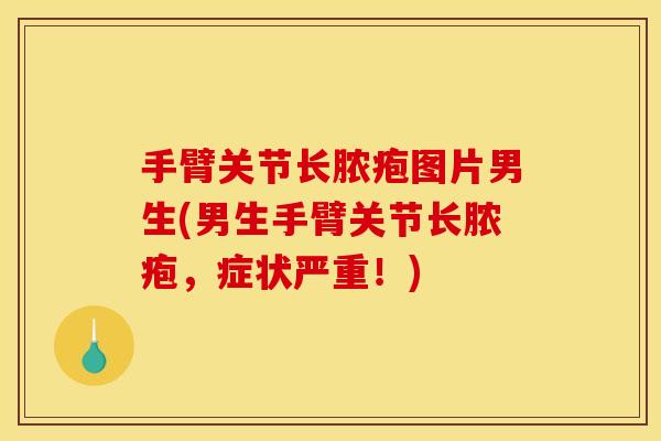 手臂关节长脓疱图片男生(男生手臂关节长脓疱,症状严重!) 手臂关节长脓疱图片男生(男生手臂关节长脓疱,症状严重!)