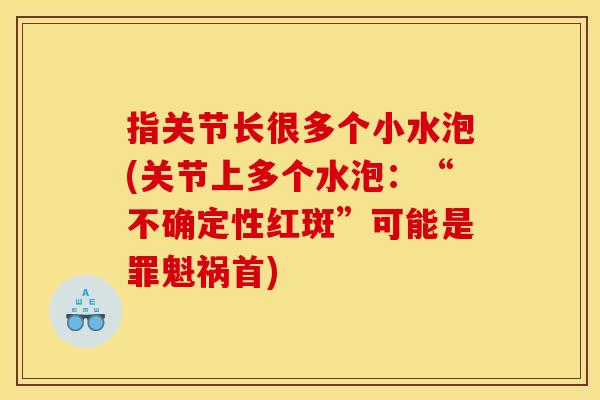 指关节长很多个小水泡(关节上多个水泡：“不确定性红斑”可能是罪魁祸首)