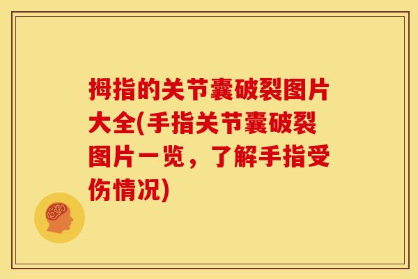 拇指的关节囊破裂图片大全(手指关节囊破裂图片一览,了解手指受伤情况) 拇指的关节囊破裂图片大全(手指关节囊破裂图片一览,了解手指受伤情况)