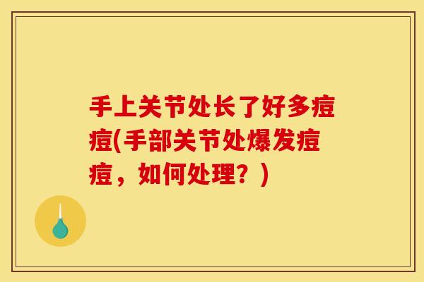 手上关节处长了好多痘痘(手部关节处爆发痘痘,如何处理?) 手上关节处长了好多痘痘(手部关节处爆发痘痘,如何处理?)