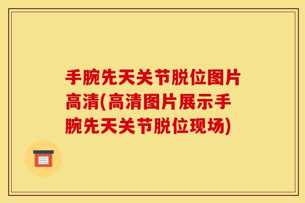 手腕先天关节脱位图片高清(高清图片展示手腕先天关节脱位现场) 手腕先天关节脱位图片高清(高清图片展示手腕先天关节脱位现场)