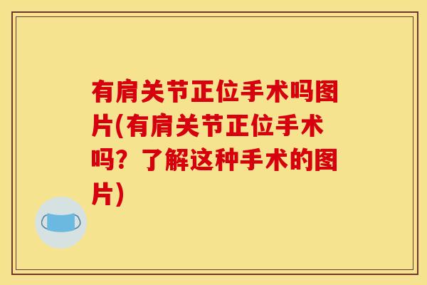 有肩关节正位手术吗图片(有肩关节正位手术吗？了解这种手术的图片)