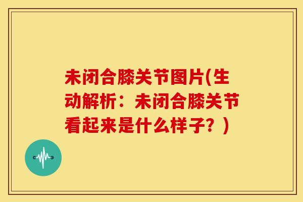 未闭合膝关节图片(生动解析：未闭合膝关节看起来是什么样子？)