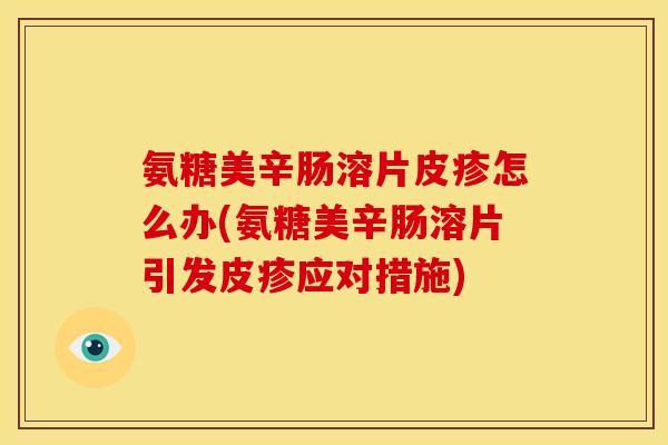 氨糖美辛肠溶片皮疹怎么办(氨糖美辛肠溶片引发皮疹应对措施) 氨糖美辛肠溶片皮疹怎么办(氨糖美辛肠溶片引发皮疹应对措施)