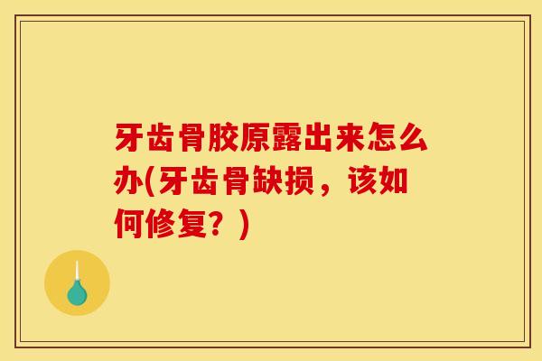 牙齿骨胶原露出来怎么办(牙齿骨缺损，该如何修复？)