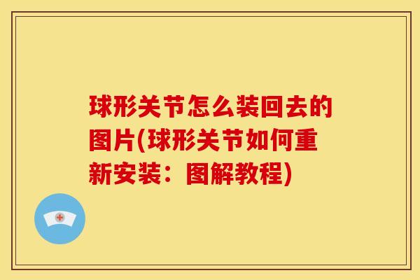 球形关节怎么装回去的图片(球形关节如何重新安装：图解教程)