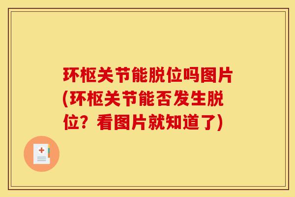 环枢关节能脱位吗图片(环枢关节能否发生脱位?看图片就知道了) 环枢关节能脱位吗图片(环枢关节能否发生脱位?看图片就知道了)