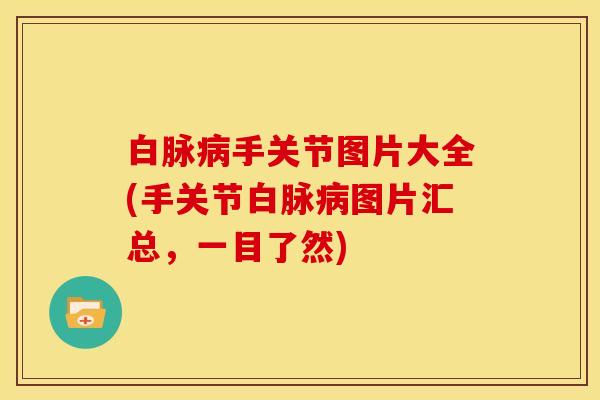 白脉手关节图片大全(手关节白脉图片汇总,一目了然) 白脉手关节图片大全(手关节白脉图片汇总,一目了然)