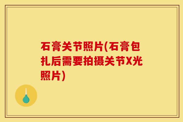石膏关节照片(石膏包扎后需要拍摄关节X光照片)