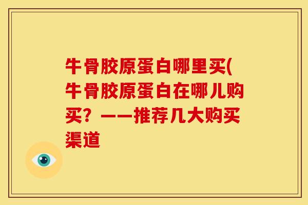 牛骨胶原蛋白哪里买(牛骨胶原蛋白在哪儿购买？——推荐几大购买渠道