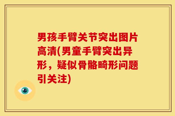 男孩手臂关节突出图片高清(男童手臂突出异形,疑似骨骼畸形问题引关注) 男孩手臂关节突出图片高清(男童手臂突出异形,疑似骨骼畸形问题引关注)