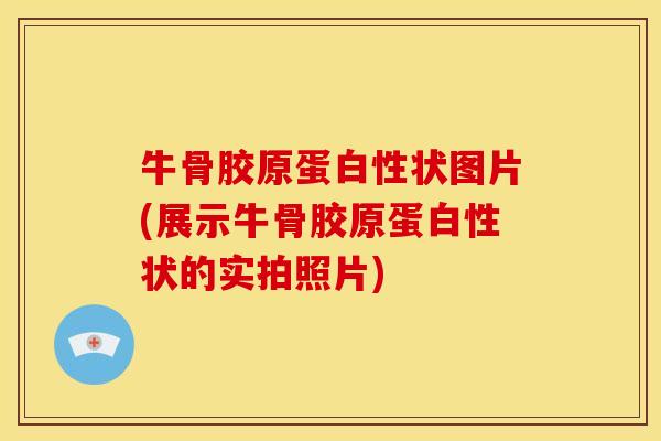 牛骨胶原蛋白性状图片(展示牛骨胶原蛋白性状的实拍照片) 牛骨胶原蛋白性状图片(展示牛骨胶原蛋白性状的实拍照片)