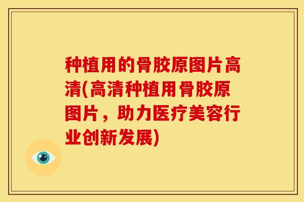 种植用的骨胶原图片高清(高清种植用骨胶原图片,助力医疗美容行业创新发展) 种植用的骨胶原图片高清(高清种植用骨胶原图片,助力医疗美容行业创新发展)