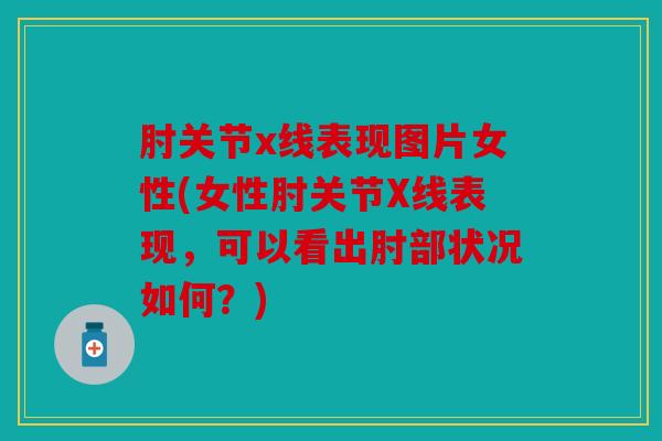 肘关节x线表现图片女性(女性肘关节X线表现，可以看出肘部状况如何？)