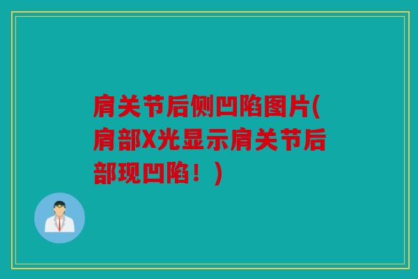 肩关节后侧凹陷图片(肩部X光显示肩关节后部现凹陷！)