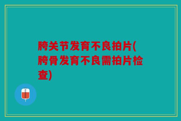 胯关节发育不良拍片(胯骨发育不良需拍片检查)