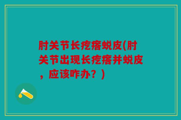 肘关节长疙瘩蜕皮(肘关节出现长疙瘩并蜕皮,应该咋办?) 肘关节长疙瘩蜕皮(肘关节出现长疙瘩并蜕皮,应该咋办?)