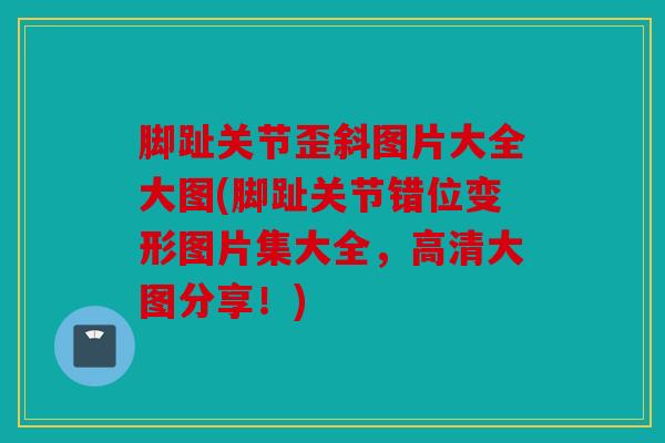 脚趾关节歪斜图片大全大图(脚趾关节错位变形图片集大全,高清大图分享!) 脚趾关节歪斜图片大全大图(脚趾关节错位变形图片集大全,高清大图分享!)