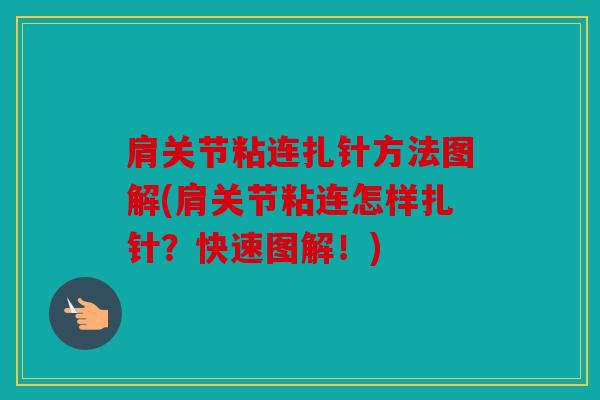 肩关节粘连扎针方法图解(肩关节粘连怎样扎针？快速图解！)